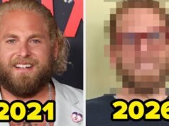 Essas 13 celebridades tiraram grandes folgas dos olhos do público, e a diferença em algumas dessas fotos de antes e depois é realmente incrível