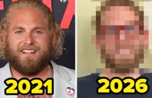 Essas 13 celebridades tiraram grandes folgas dos olhos do público, e a diferença em algumas dessas fotos de antes e depois é realmente incrível