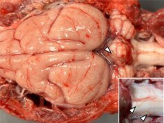 Um verme invasor do cérebro espalhado por ratos e caracóis chegou à Califórnia