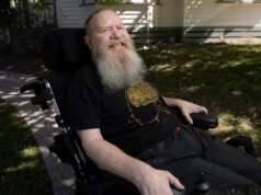 Como é ter um implante cerebral por 5 anos