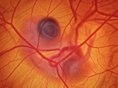 Como você fotografa uma galinha dentro de um ovo?