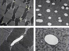 Estudo desafia a teoria popular sobre por que os insetos primordiais eram tão enormes