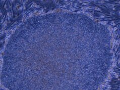 Japão aprova o primeiro tratamento do mundo feito com células humanas reprogramadas