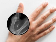 Microchips subcutâneos obrigatórios para funcionários podem em breve ser banidos no estado de Washington