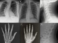 Médicos lutam para detectar raios X gerados por IA, aumentando riscos de fraude