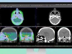 Studio Display XDR da Apple suporta imagens médicas DICOM para radiologia diagnóstica