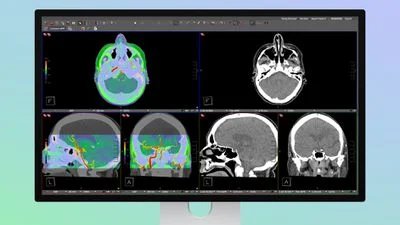 studio-display-xdr-medical-presets.jpg