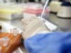 Supercarregar células imunológicas pode ajudar a controlar o HIV a longo prazo