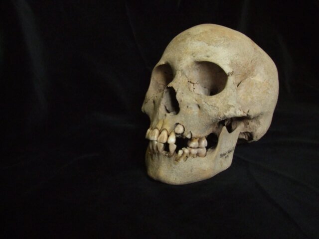 plague-victim-skull-1280x960.jpeg