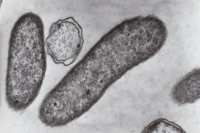 vibriobacteria-1280x853.jpg